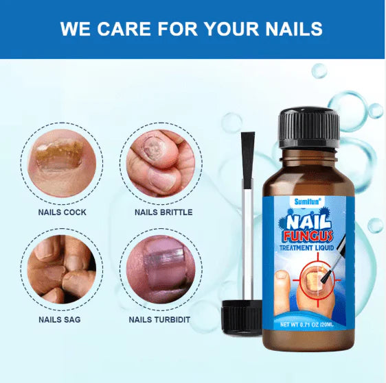 Sumifun - Nail Fungus Treatment Liquid